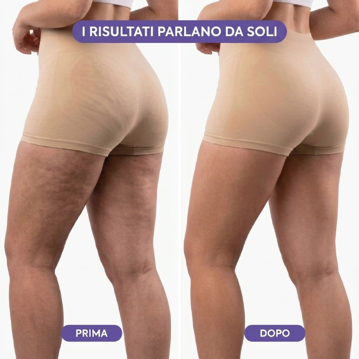Hylysis SculptPro™ – Massaggiatore Rimodellante a Percussione e Rotazione